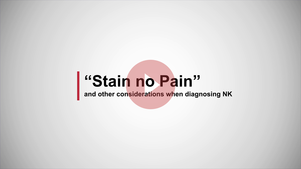 The meaning of "stain no pain"